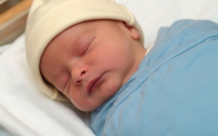 Bebeklerde Sarılık