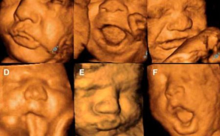 Bebekler Ağlamayı Doğmadan Önce mi Öğrenir?
