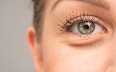 Göz Altı Torbalarına Elveda