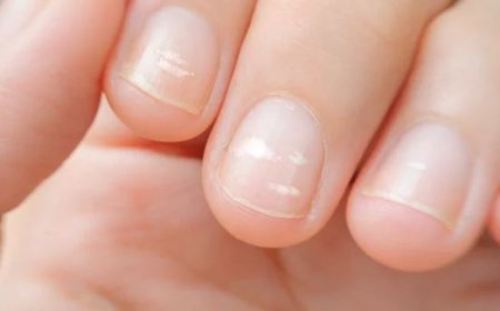 Tırnaklardaki Beyaz Lekeler