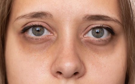 Koyu Göz Altı Morluklarından Kurtulun!