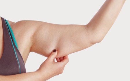 Kilo Verdikten Sonra Gevşek Cilt Sorunu Nasıl Önlenir?